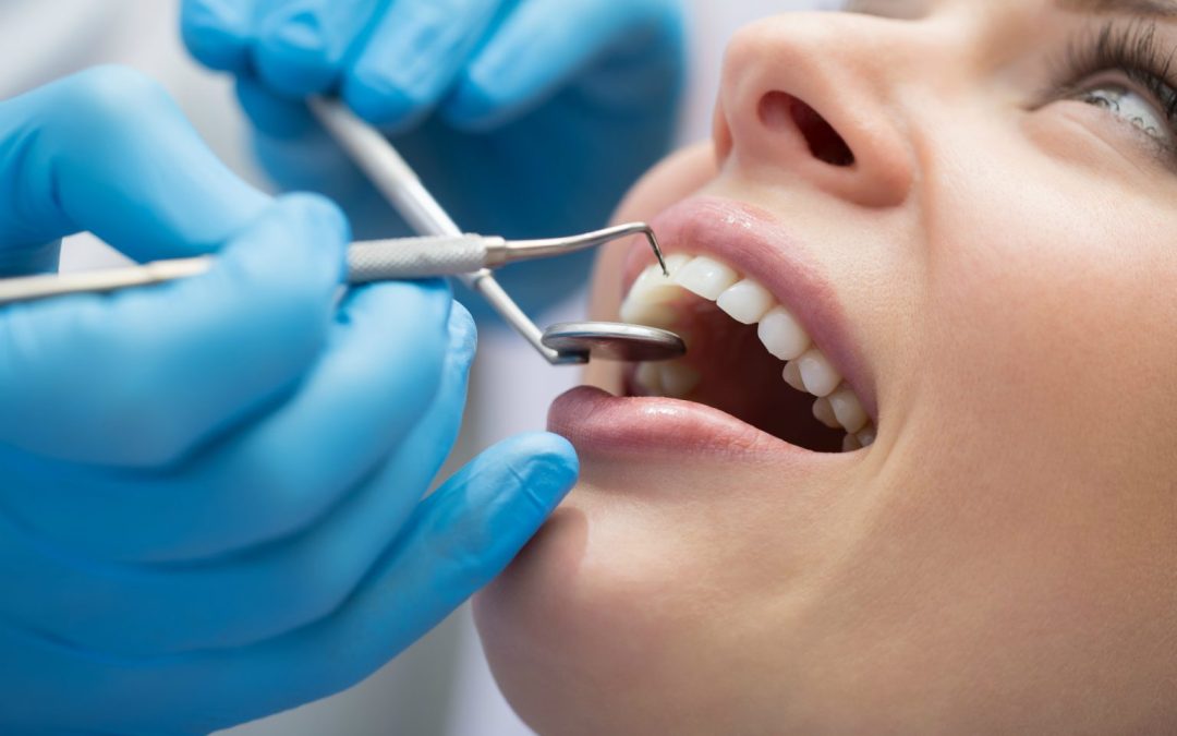 Why Regular Dental Checkups Matter More Than You Think